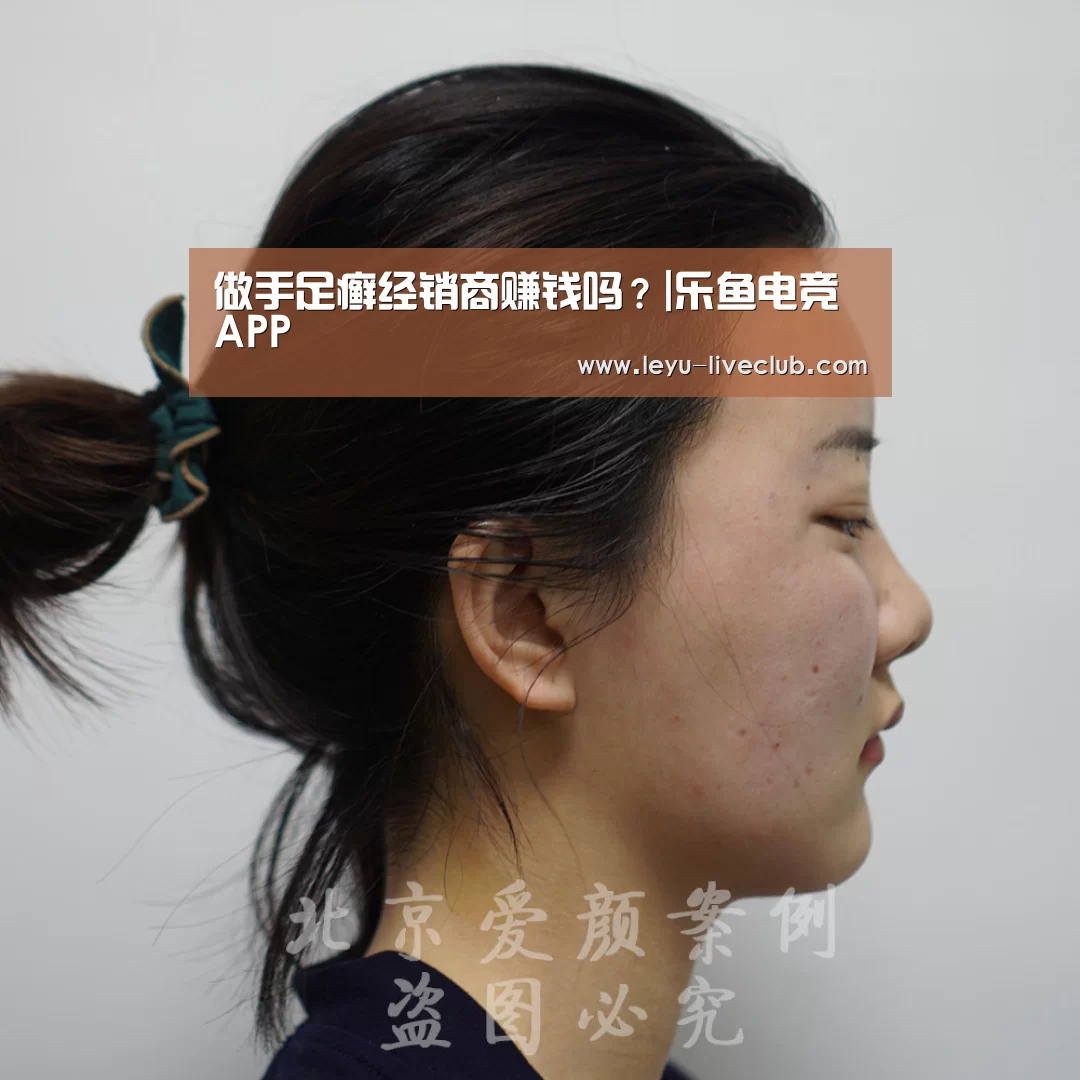 做手足癣经销商赚钱吗?|乐鱼电竞APP(图1) 乐鱼电竞APP